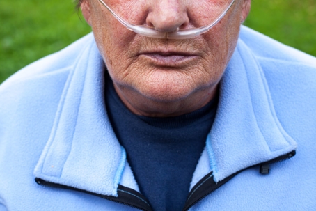 A person wearing a nasal cannula